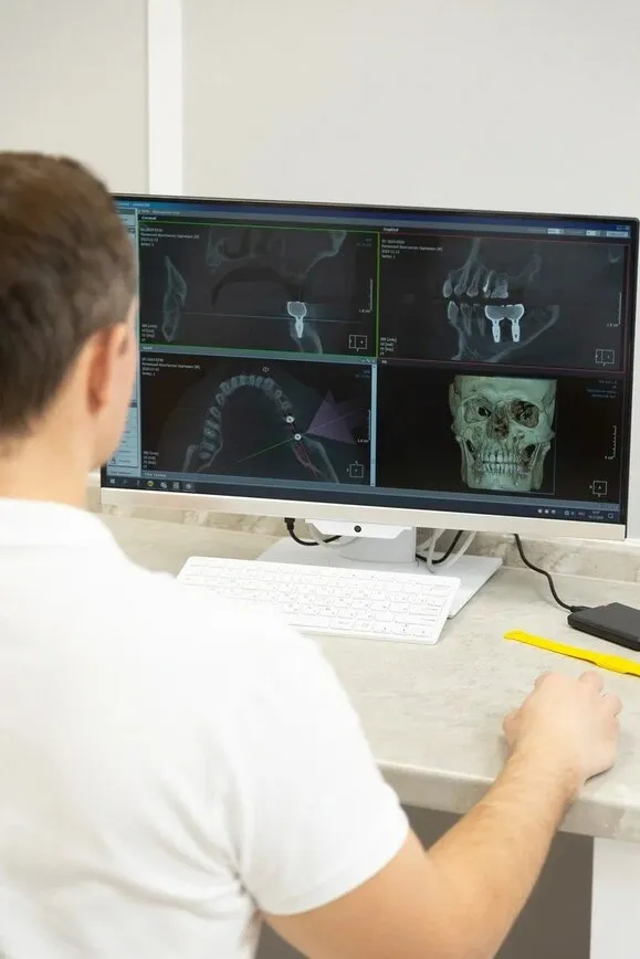 Врач-стоматолог изучает 3D-снимки челюсти для планирования имплантации.