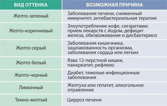 Желтый налет с оттенками Лечение зуба в Челябинске