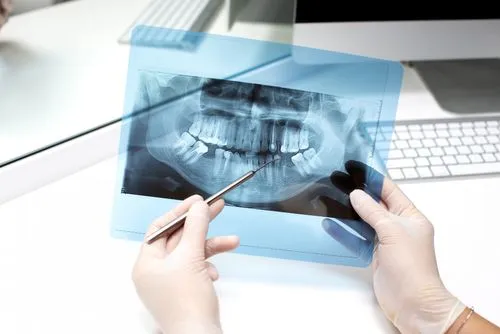 Ортопантомограмма x-ray implant.jpg