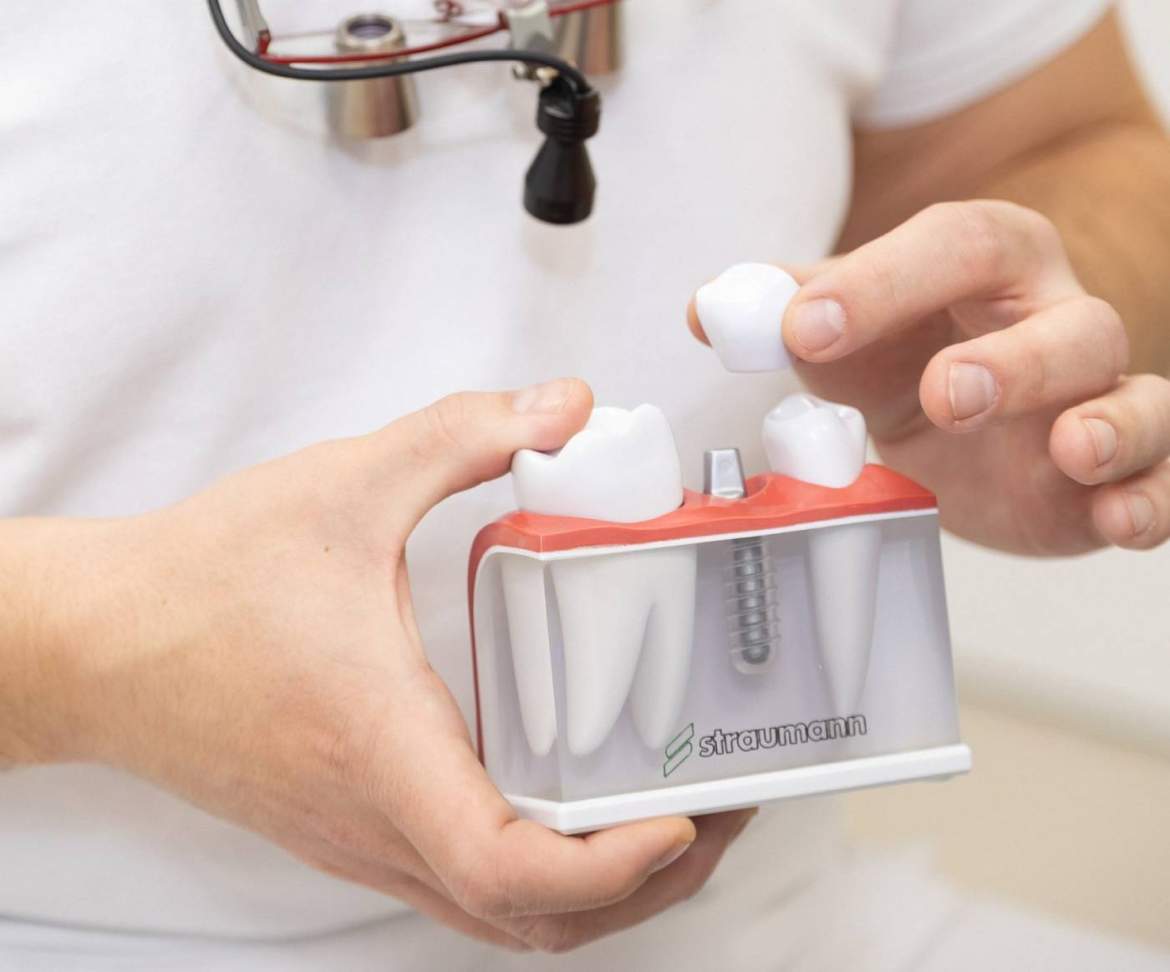Zubnoy implant Straumann