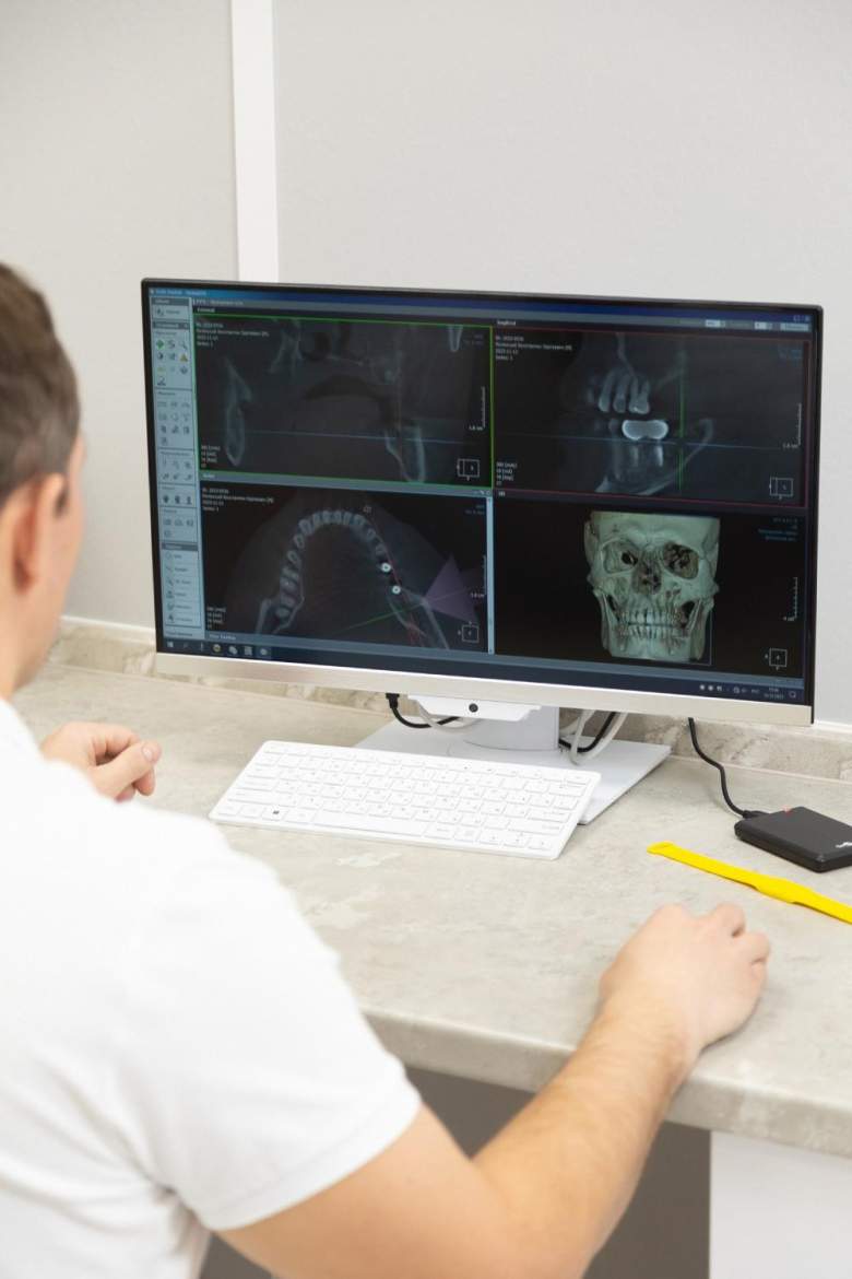 Анализ 3D-снимка челюсти пациента