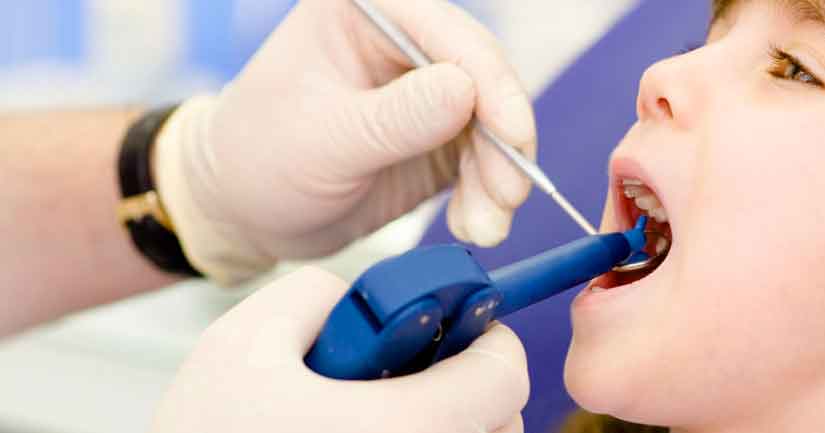 Глубокое фторирование зубов у детей — надежный способ сохранить здоровье