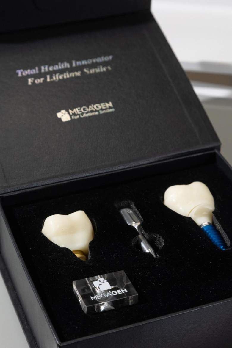 Компоненты системы имплантации