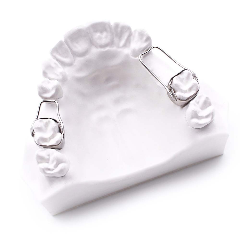 ортодонтические кольца
