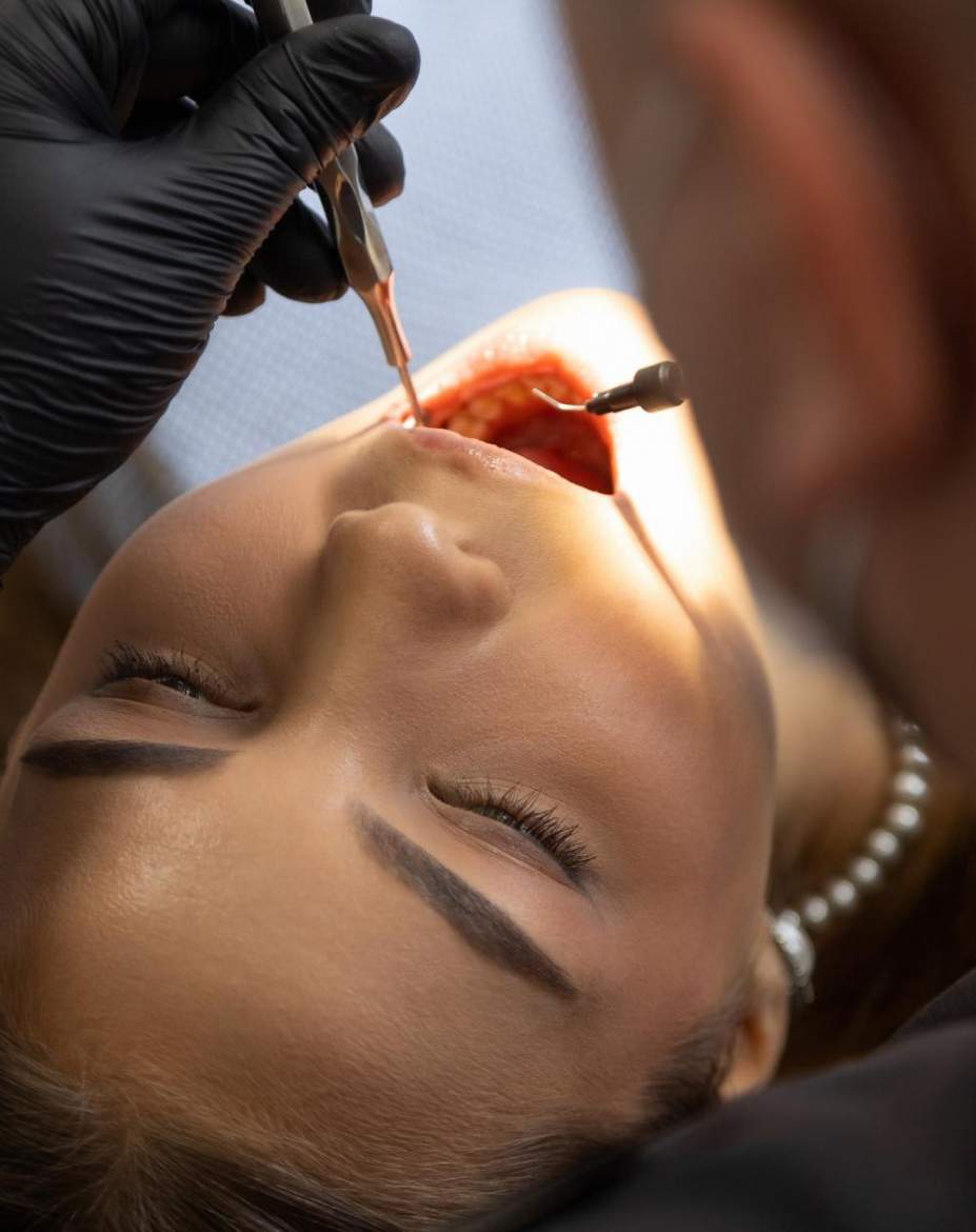 Осмотр полости рта